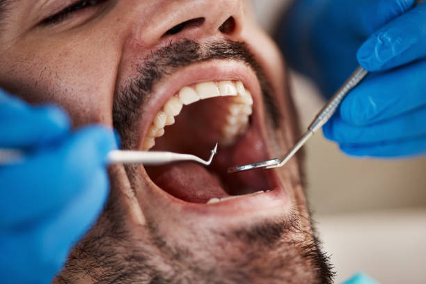 Best Urgent Tooth Repair  in Leawood, KS